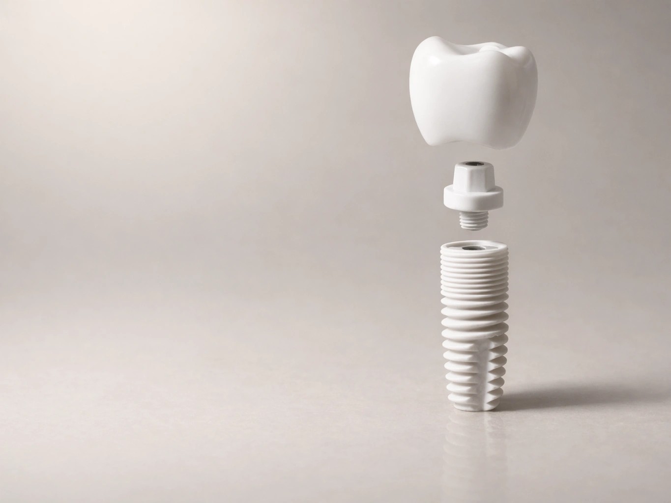 Implantate – Keramik oder Titan? Eine Übersicht