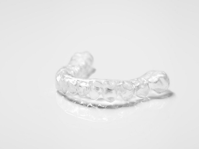 Alignertherapie — transparente Zahnschienen
